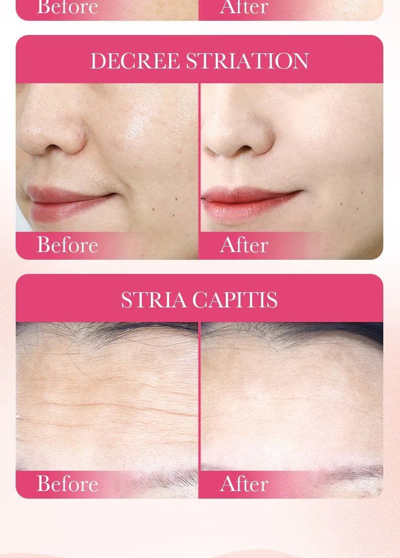 Korean Snail Mucin Sheet Mask
