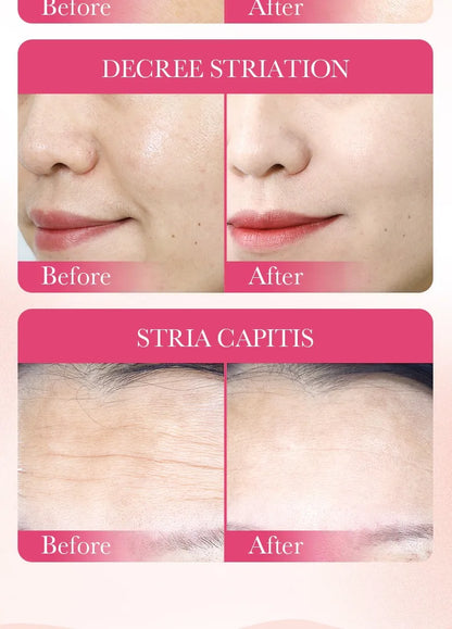 Korean Snail Mucin Sheet Mask