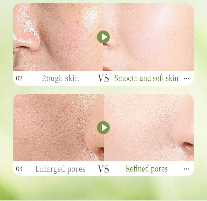 Korean Salicylic Acid Pore Shrinking Mask